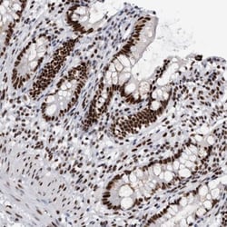 RBM6 Antibody, Novus Biologicals 0.1mL; Unlabeled:Antibodies, Polyclonal